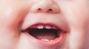 Langkah Ampuh Merawat Gigi Bayi: Panduan Komprehensif untuk Orang Tua